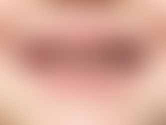 How Fluoride can help PREVENT cavities for our children.