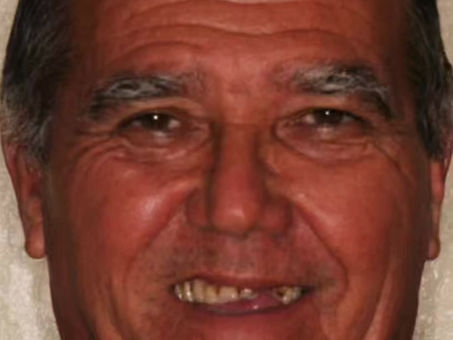 Did You know? Your Adult Teeth Can Last a Lifetime if You Take Good Care of Your Oral Hygiene.