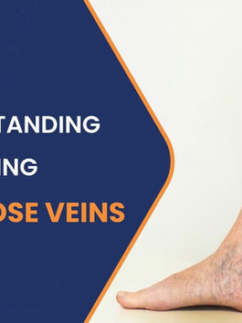Modern Solutions for Varicose Veins by Jaipur’s Trusted Vascular Surgeon