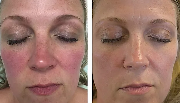 Marketing - Rhonda Allison before and pe