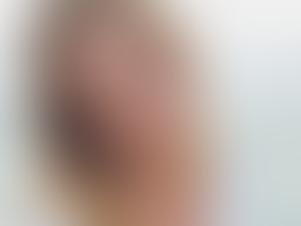 Don’t Let Laugh Lines Take Away Your Smile