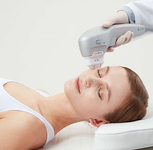 ultraformer na pratica.jpg