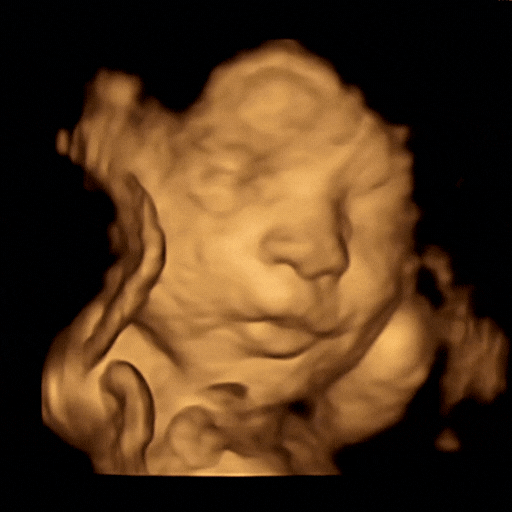 Stunning 4D ultrasound image showcasing a baby’s detailed features, capturing precious moments with Prenatal Cinemas' advance