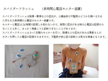 スパイダーフラッシュについて