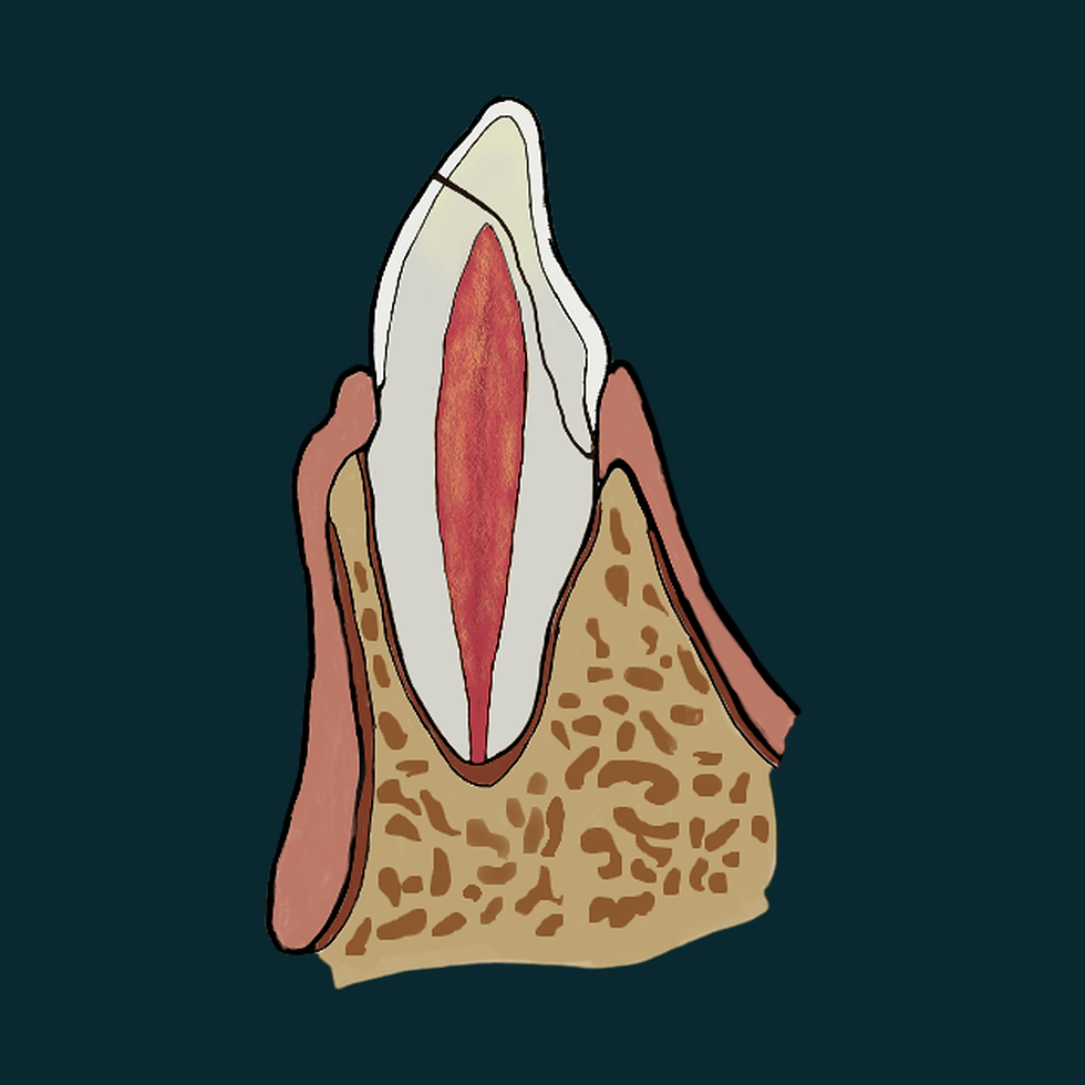 dente-sem-marca-05-1080x1080.png
