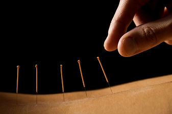 Needles in the skin on a person's back.
