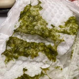 alaptat exclusiv, bebe sanatos scaunul bebelusilor scaune normale scaune mucus scaune sange klebsiella coprocultura galerie foto 