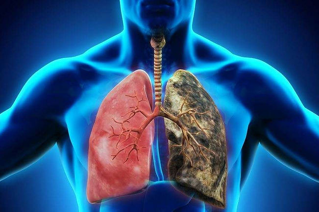 Doenças-pulmonares.jpg