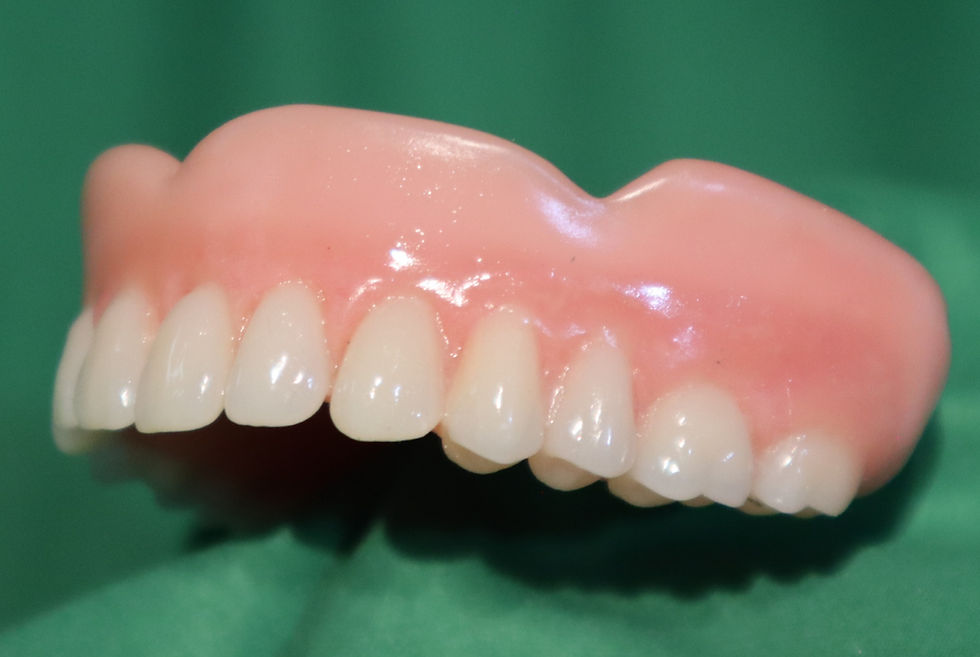 Thumbnail: DENTURES NOW  FULL UPPER DENTURE