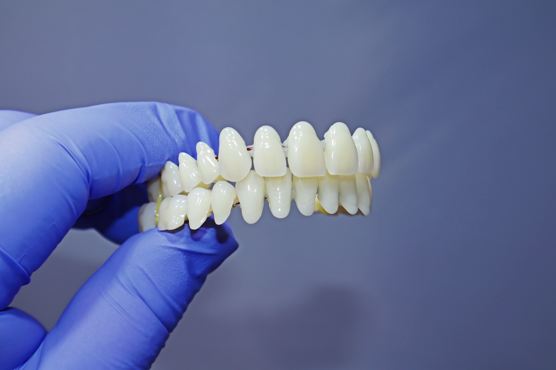 Full  Upper and full lower  Placed Acrylic Denture teeth