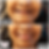 Full Denture