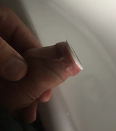 Phimosis ring size 10 fitted
