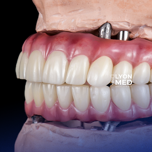 lyonmed-implant-paketi.png