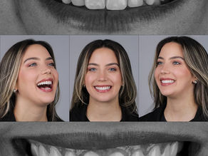 Vaka İncelemesi Zirkonyum Kaplama