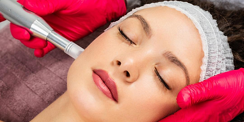 microneedling with PRP.png