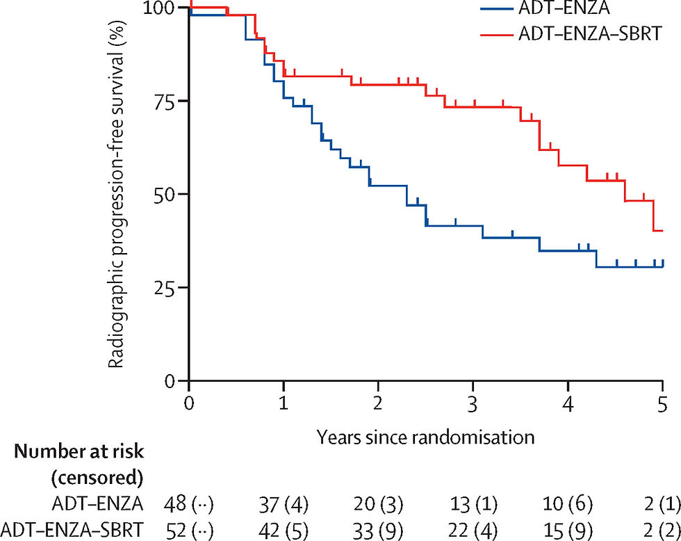 前列腺癌治療新突破：SBRT 精準電療結合荷爾蒙藥物，效果倍增！