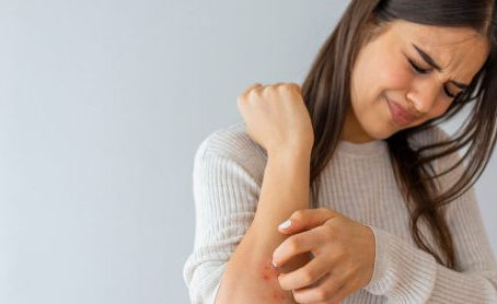 中醫藥治療皮膚敏感