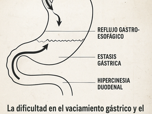  DOCUMENTO GENERADO POR INTELIGENCIA ARTIFICIAL AUTOMÁTICAMENTE DE LAS PLATAFORMAS MEDICAS MÁS AVANZADAS, SOBRE EL REFLUJO DUODENO GÁSTRICO O GASTRITIS BILIAR O ALCALINA.