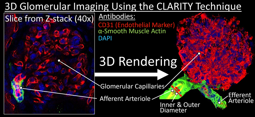 3D Glomeruli.tif