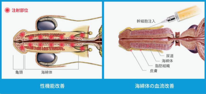 스크린샷 2026-07-09 오전 12.32.44.png