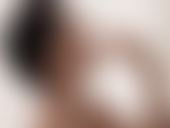 Advantages and Disadvantages of Liquid Rhinoplasty Compared to Traditional Surgical Rhinoplasty