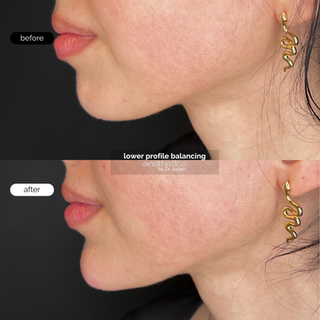 lower profile balancing (1).png