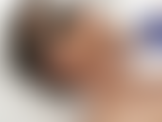 How Should You Prepare for Laser Hair Removal