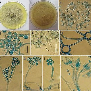 Microscopic slides of fungal structures with blue and beige hues are displayed in multiple sections, showcasing varied spore formations.