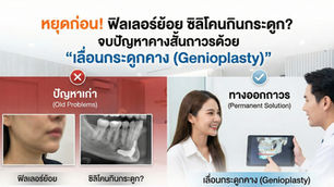 หยุดก่อน! ฟิลเลอร์ย้อย ซิลิโคนกินกระดูก? จบปัญหาคางสั้นถาวรด้วย "เลื่อนกระดูกคาง (Genioplasty)"