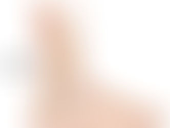 How to Identify and Treat Achilles Pain