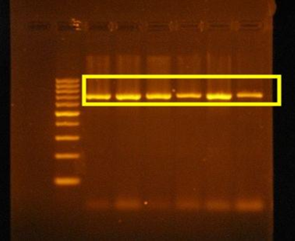 Figure 4. PCR Analysis of Van Cat (Agarose Gel Image). (Image obtained from our laboratory work).