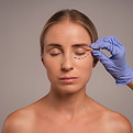 Blefaroplastia.jpg