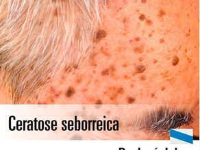 Ceratose Seborreica