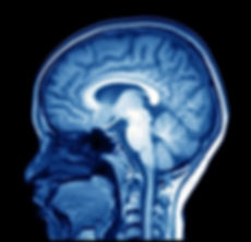 magnetic resonance image (MRI) of the br