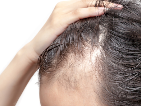 ¿La finasterida para la caída del pelo empeora tu erección? Lo que dice la evidencia