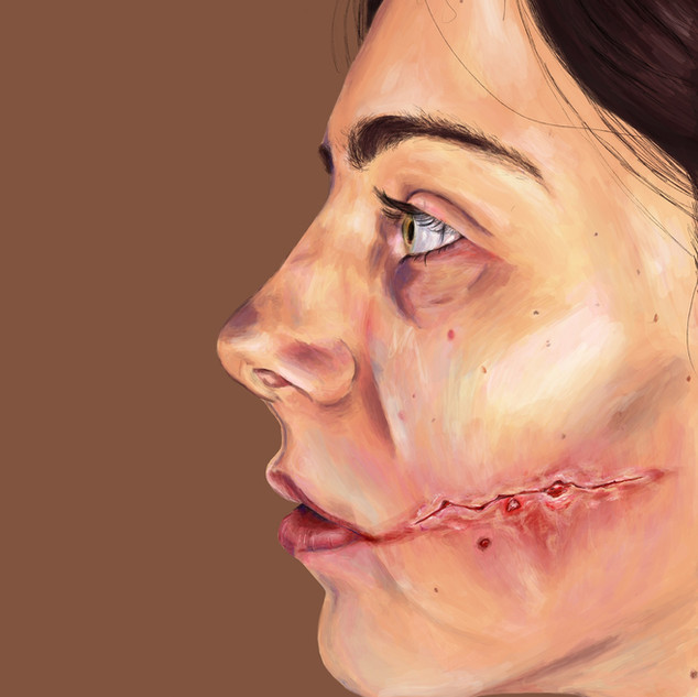 Torn up