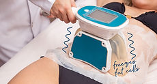 Fat-Freeze cryolipolysis