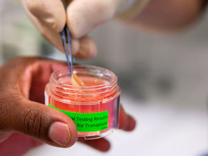 Corneal Transplantation in Namibia