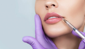 preenchimento labial.jpeg