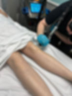 Laser Technician performing Painless Laser Hair Removal with Motus AX at Drip IV Wellness & MedSpa