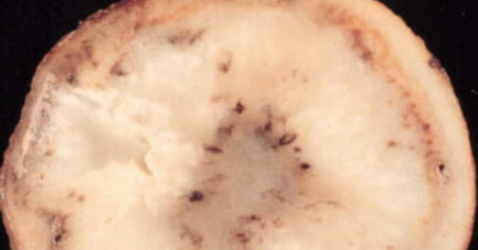 Verticilosis en patata | idMicrobe