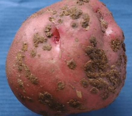 Sarna pulverulenta o roña en patata | idMicrobe