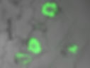 Powdery mildew haustoria labeled with AlexaFluor observed under fluorescence in a confocal laser microscope