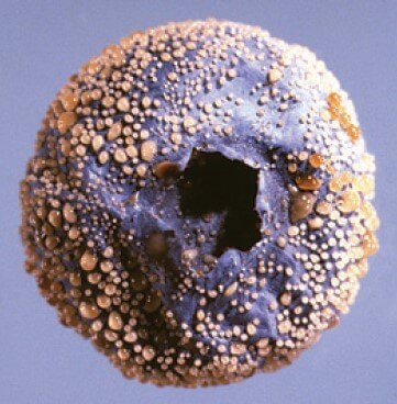 Antracnosis en arándano | idMicrobe