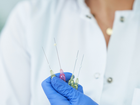 What Areas Can PDO Threads Treat?