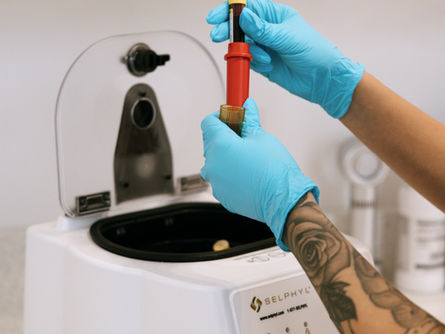 PRF Injections St. Pete