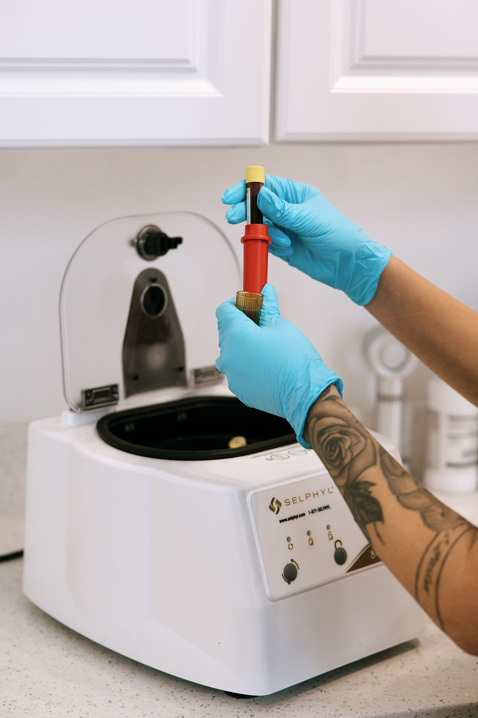 PRF Injections St. Pete
