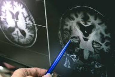 Brain MRI