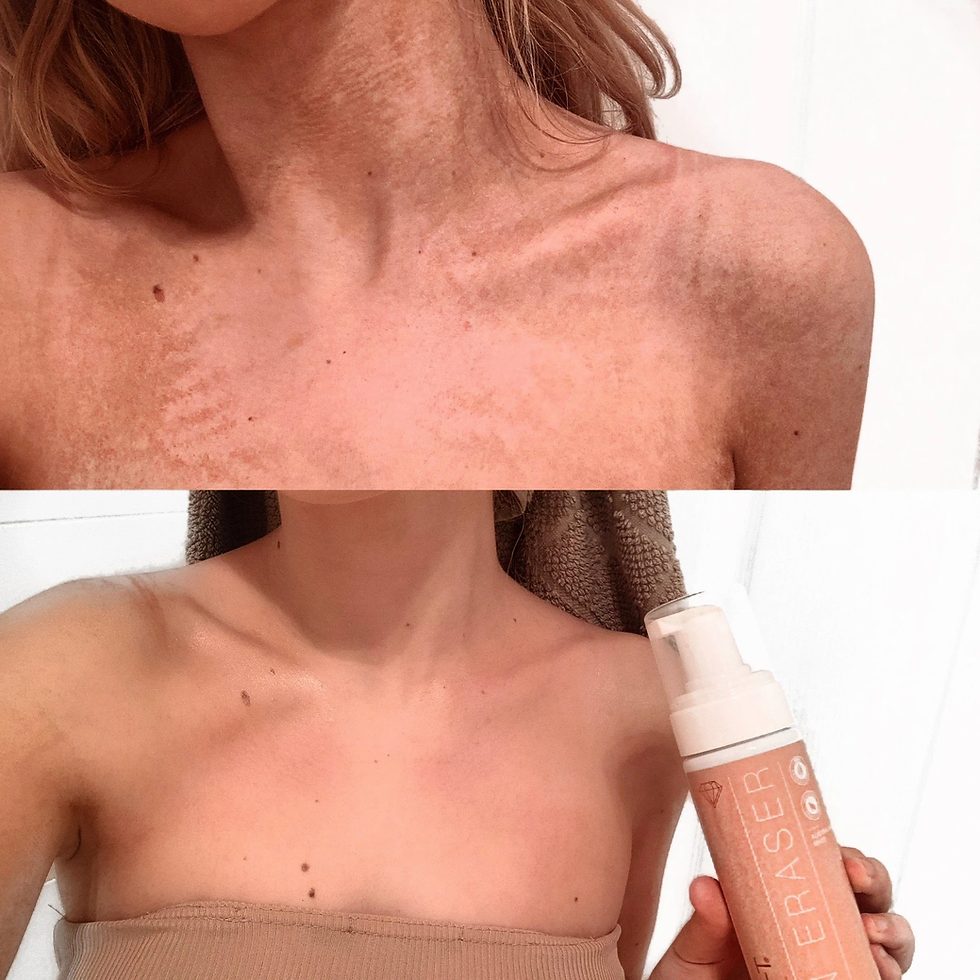 Thumbnail: Tan Eraser - Tan Removal Mousse - 200ml