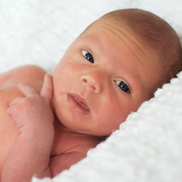 newborn_baby_dry_skin_600x600_crop_center.webp